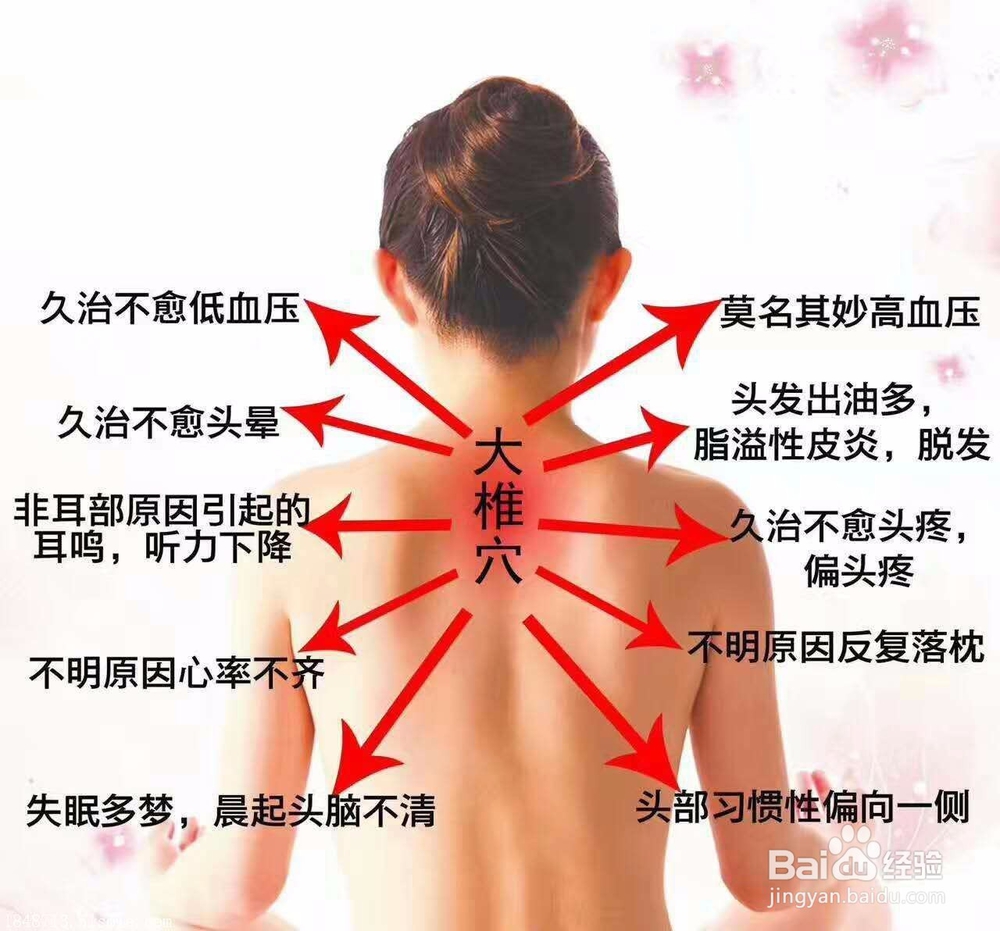 富贵包的成因、危害及其缓解预防、消除方法