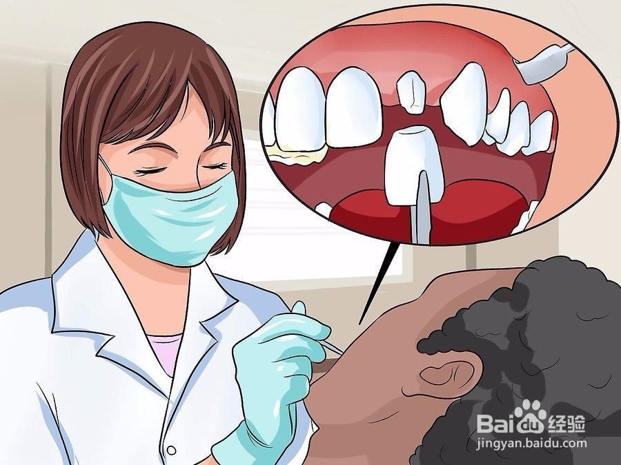 如何修复牙釉质