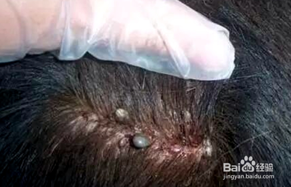 白醋去虱子卵最简单的方法