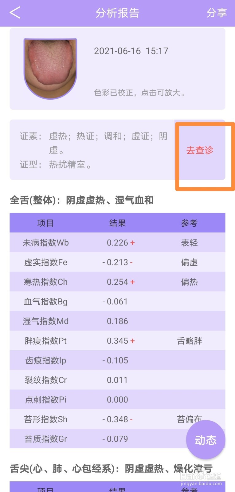 如何用“看舌头App”自查健康状态