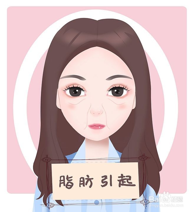 法令纹的类型