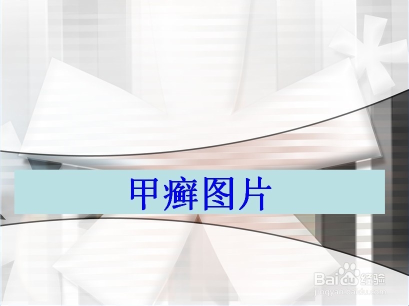 甲癣图片是什么