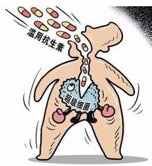 霉菌性阴道炎该如何预防