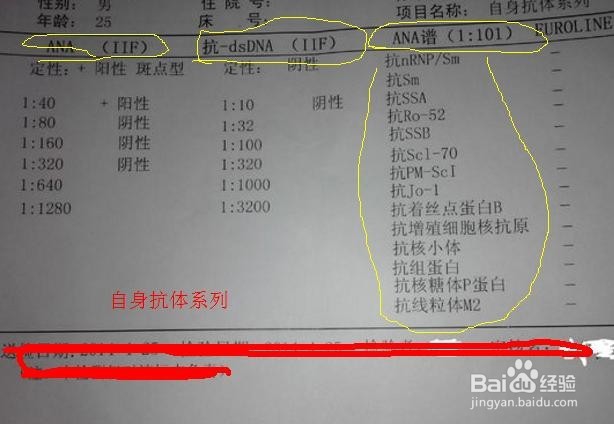 哪些情况需要到风湿免疫科就诊