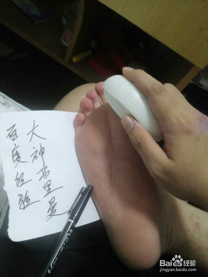 如何去除脚板死皮