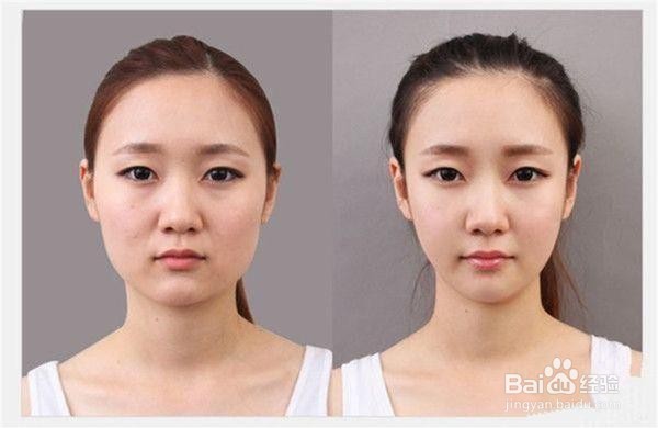 婴儿肥怎样才能瘦脸最快方法动作(图文解)