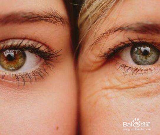 怎样消除眼角皱纹