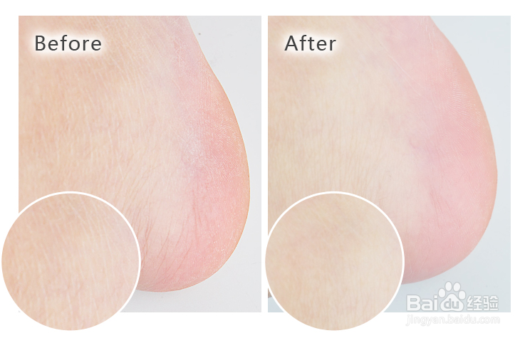 PROFOOT护足霜的使用方法