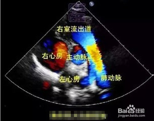 诊断晕厥有什么方法?