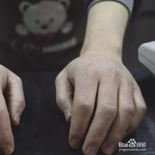 手粗糙干燥怎么能细嫩