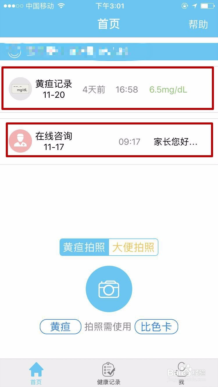 怎么用哪吒保贝APP检测宝宝黄疸?