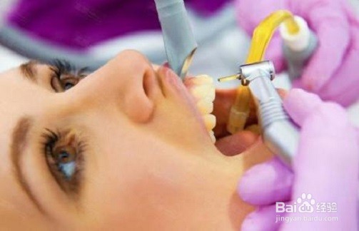 洗牙的好处与坏处