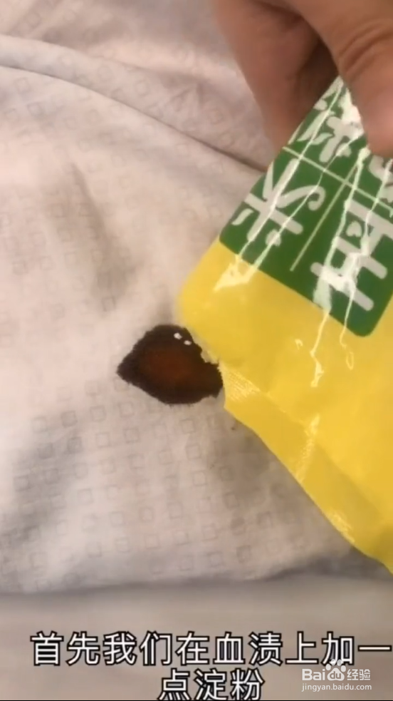 如何去除衣服上的血迹？