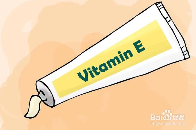 如何摆脱静脉曲张