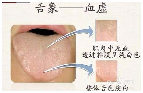 2017年最有效的4种祛湿气方法