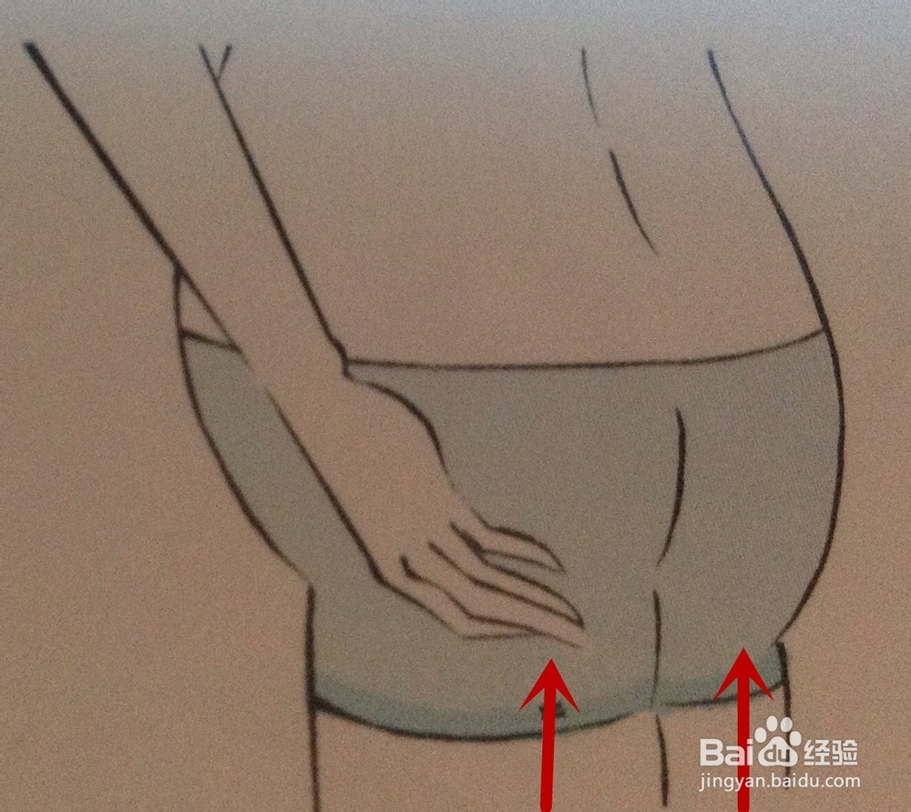 怎样预防妊娠纹