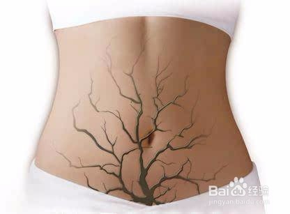 肠道垃圾对身体的危害