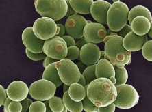 酵母菌怎么繁殖