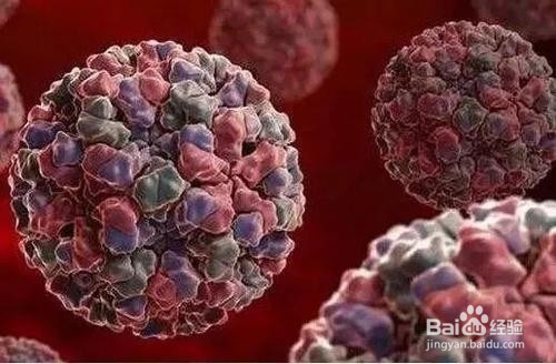 脱髓鞘病变严重吗？