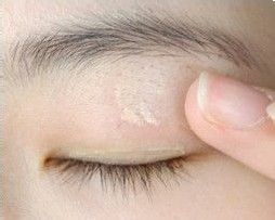 怎么贴好双眼皮贴