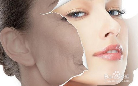 产后雀斑变多为什么/雀斑增多怎么办