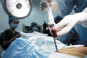 骨髓捐献会影响身体健康吗？