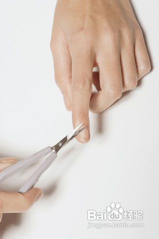 手指关节发黑 肿大 洗不掉