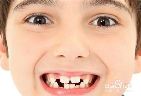 小儿牙齿保健