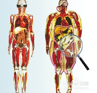 精神病遗传鸡皮肤是什么(儿童遗传性鸡皮肤能根治吗) 精神病遗传鸡皮肤是什么(儿童遗传性鸡皮肤能根治吗)