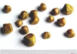 怎样预防肾结石？