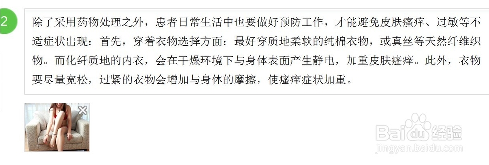 皮肤瘙痒用什么药膏