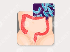 急性肠炎的症状