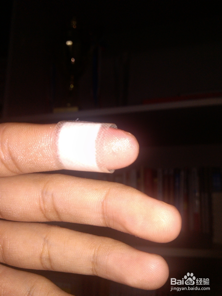 手被烫伤怎么办?