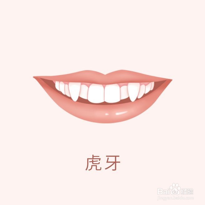 牙齿矫正类型
