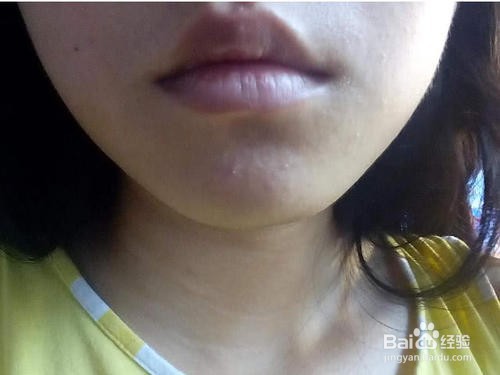 嘴巴颜色暗沉怎么办