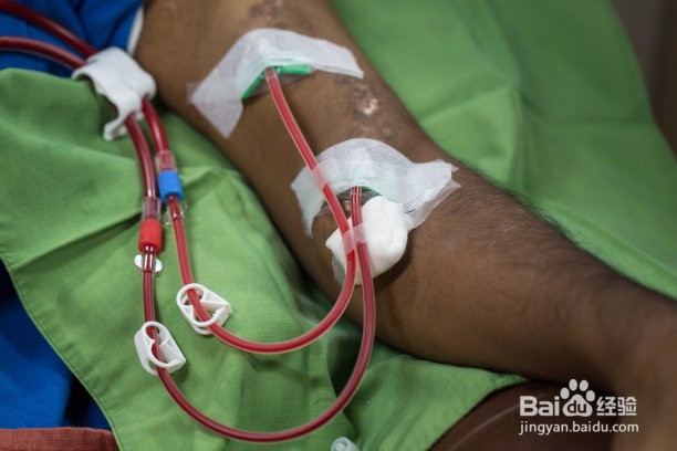 长期透析怎么报销