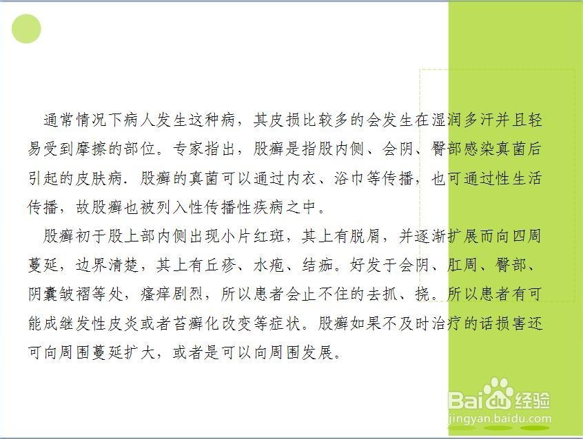 大腿肚内侧股癣用什么药