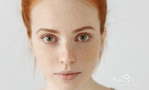 雀斑如何防治与清除