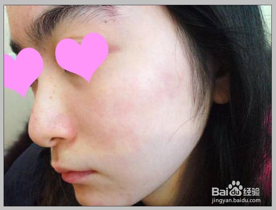 PS怎么去掉照片脸上的痘印斑点