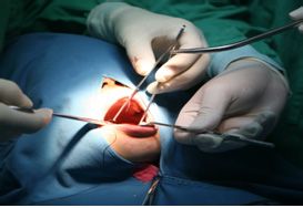 成人牙周炎该怎么治疗