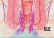 小孩把尿到底好不好,要不要给小孩把尿?