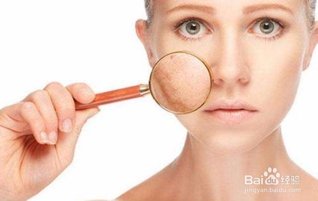 脸上长痘饮食上应该注意什么