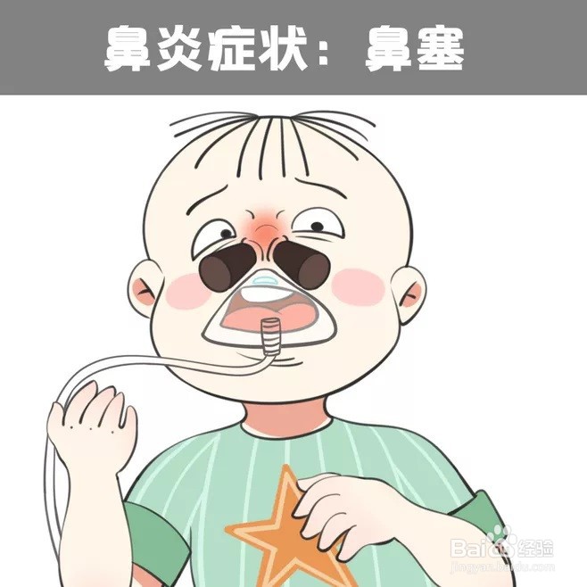 小孩鼻炎症状图片图片