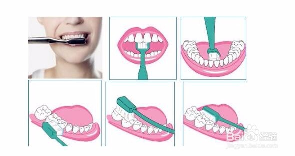 为什么每天刷牙牙齿还是黄