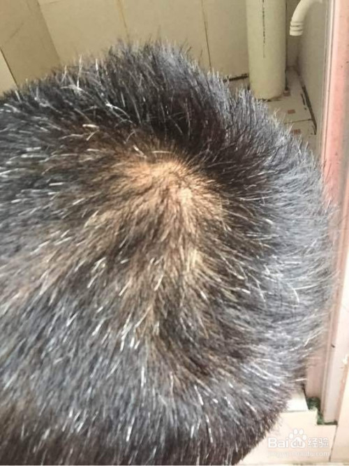 头发变白的几种原因-百度经验