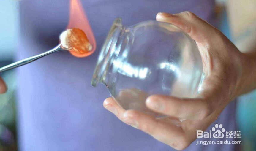 拔火罐的常见误区