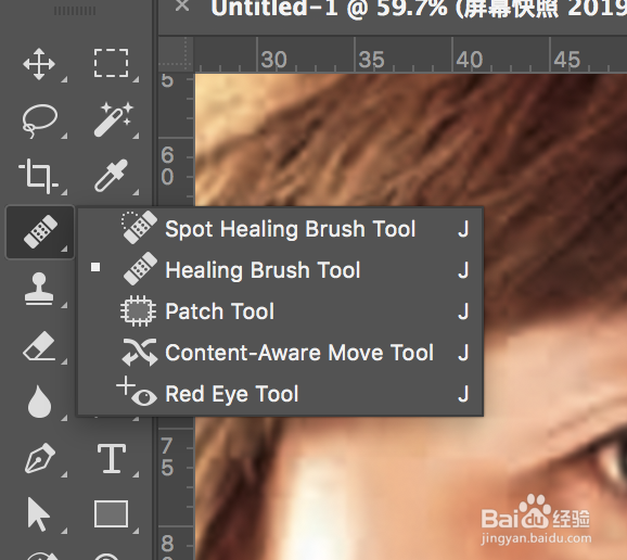 怎么P掉脸上的痣