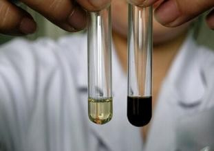 肾炎吃什么食物好