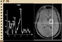 MRI的检查方法有哪些