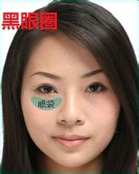 有黑眼圈，眼纹，眼袋怎么办及处理方法